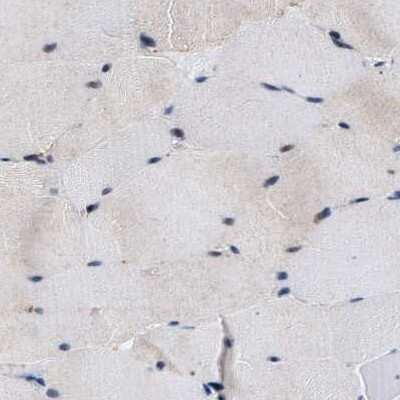 Immunohistochemistry-Paraffin: hHpr1-p84-Thoc1 Antibody [NBP1-89669]
