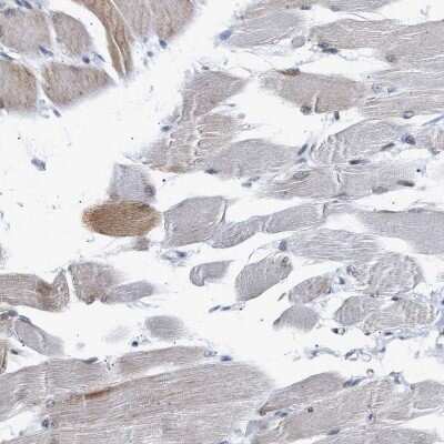 Immunohistochemistry-Paraffin: hHpr1-p84-Thoc1 Antibody [NBP1-89670]