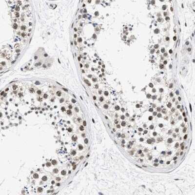 Immunohistochemistry-Paraffin: hHpr1-p84-Thoc1 Antibody [NBP1-89670]