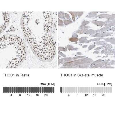 Immunohistochemistry-Paraffin: hHpr1-p84-Thoc1 Antibody [NBP1-89670]