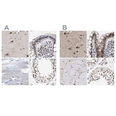 Immunohistochemistry-Paraffin: hHpr1-p84-Thoc1 Antibody [NBP1-89670]