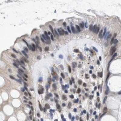 Immunohistochemistry-Paraffin: hHpr1-p84-Thoc1 Antibody [NBP1-89670]