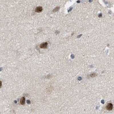 Immunohistochemistry-Paraffin: hHpr1-p84-Thoc1 Antibody [NBP1-89670]