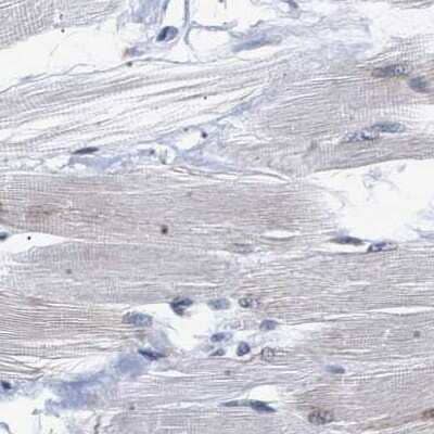 Immunohistochemistry-Paraffin: hHpr1-p84-Thoc1 Antibody [NBP1-89670]