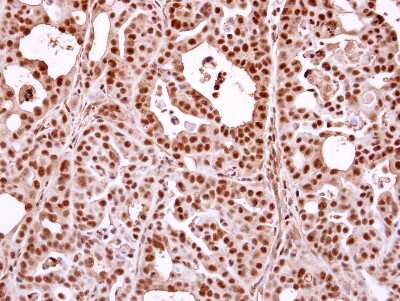 Immunohistochemistry-Paraffin: hHpr1-p84-Thoc1 Antibody [NBP2-16822]