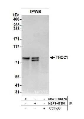 Immunoprecipitation: hHpr1-p84-Thoc1 Antibody [NBP1-47304]