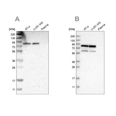 Western Blot: hHpr1-p84-Thoc1 Antibody [NBP1-89669]