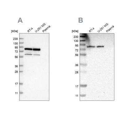 Western Blot: hHpr1-p84-Thoc1 Antibody [NBP1-89670]