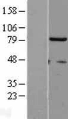 Western Blot: hHpr1-p84-Thoc1 Overexpression Lysate [NBL1-16887]