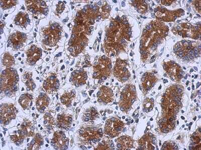 Immunohistochemistry-Paraffin: RENT1/UPF1/hUPF1 Antibody [NBP2-16905]