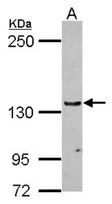 Western Blot: RENT1/UPF1/hUPF1 Antibody [NBP2-16905]