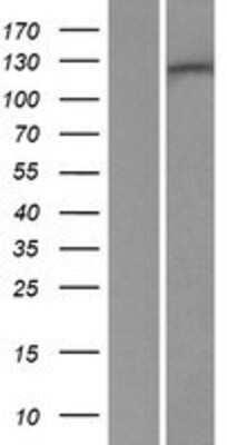 Western Blot: RENT1/UPF1/hUPF1 Overexpression Lysate [NBP2-10854]