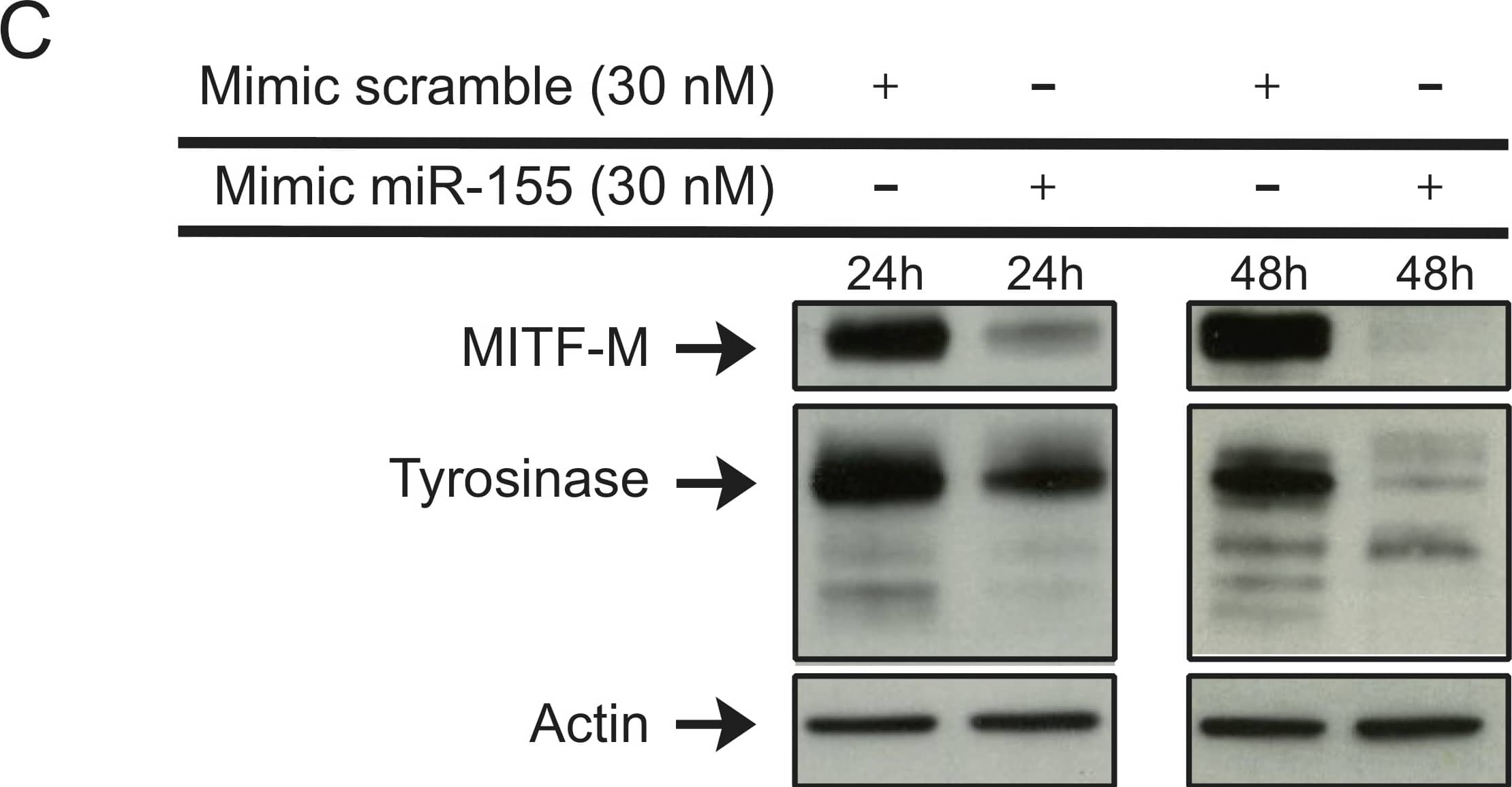 Detection of Human IgG by Western Blot