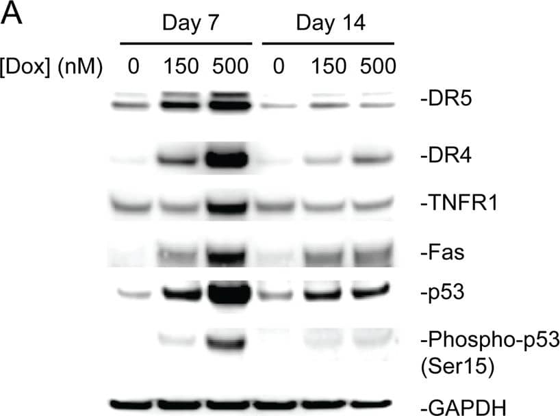 Detection of Human p53 by Western Blot