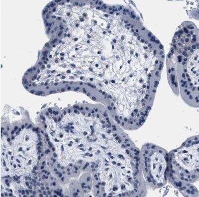 Immunohistochemistry-Paraffin: Myosin Heavy Chain 3 Antibody [NBP1-89707]