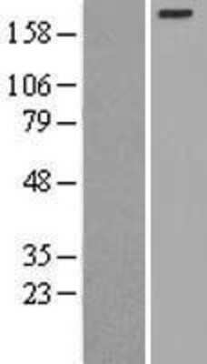 Western Blot: Myosin Heavy Chain 3 Overexpression Lysate [NBL1-13422]