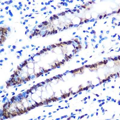 Immunohistochemistry-Paraffin: hnRNP A1 Antibody (10N0F4) [NBP3-15405]