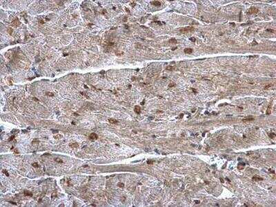 Immunohistochemistry-Paraffin: hnRNP A1 Antibody [NBP1-32161]