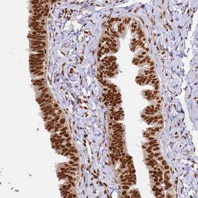 Immunohistochemistry-Paraffin: hnRNP A1 Antibody [NBP2-14096]