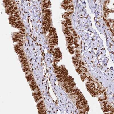 Immunohistochemistry-Paraffin: hnRNP A1 Antibody [NBP2-14096]