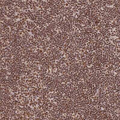 Immunohistochemistry-Paraffin: hnRNP A1 Antibody [NBP2-14096]