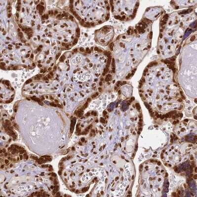 Immunohistochemistry-Paraffin: hnRNP A1 Antibody [NBP2-14096]
