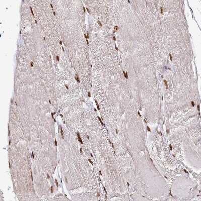 Immunohistochemistry-Paraffin: hnRNP A1 Antibody [NBP2-14096]