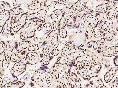 Immunohistochemistry-Paraffin: hnRNP A1 Antibody [NBP2-97829]