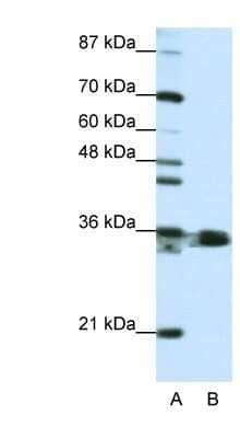 Western Blot: hnRNP A1 Antibody [NBP1-57121]