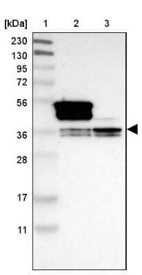 Western Blot: hnRNP A1 Antibody [NBP2-14096]