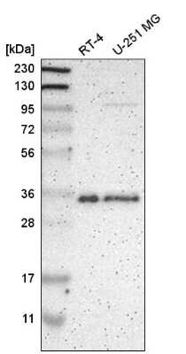 Western Blot: hnRNP A1 Antibody [NBP2-58898]