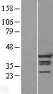 Western Blot: hnRNP A1 Overexpression Lysate [NBL1-11635]