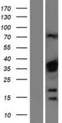 Western Blot: hnRNP A1 Overexpression Lysate [NBP2-06143]