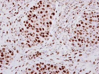 Immunohistochemistry-Paraffin: hnRNP A2B1 Antibody [NBP2-16864]
