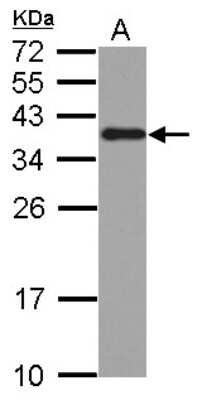 Western Blot: hnRNP A2B1 Antibody [NBP2-16864]