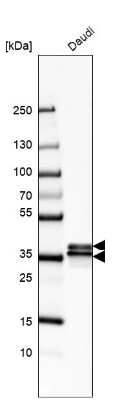 Western Blot: hnRNP A2B1 Antibody [NBP2-56497]