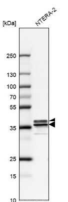 Western Blot: hnRNP A2B1 Antibody [NBP2-58872]