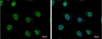 Immunocytochemistry/ Immunofluorescence: hnRNP AB Antibody [NBP2-16865]