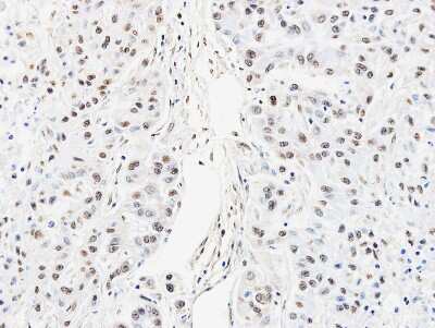 Immunohistochemistry-Paraffin: hnRNP AB Antibody [NBP2-16865]