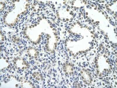 Immunohistochemistry-Paraffin: hnRNP AB Antibody [NBP2-87581]