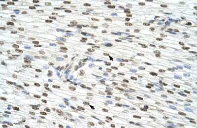 Immunohistochemistry-Paraffin: hnRNP AB Antibody [NBP2-87582]