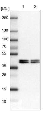 Western Blot: hnRNP AB Antibody [NBP1-91999]