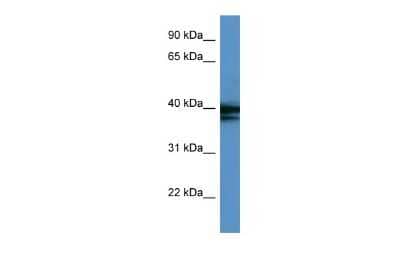 Western Blot: hnRNP AB Antibody [NBP2-87581]