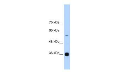 Western Blot: hnRNP AB Antibody [NBP2-87582]