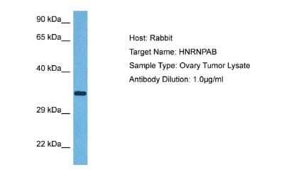 Western Blot: hnRNP AB Antibody [NBP2-87583]