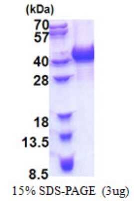 SDS-PAGE: Recombinant Human hnRNP AB His Protein [NBP2-23119]