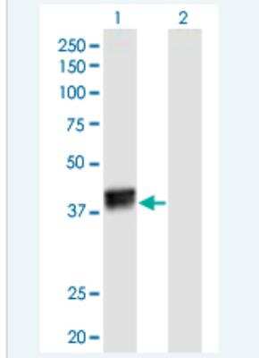 Western Blot: hnRNP C1 + C2 Antibody (4E8) [H00003183-M02-100ug]