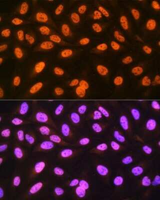 Immunocytochemistry/ Immunofluorescence: hnRNP C1 + C2 Antibody (7A10N5) [NBP3-16725]