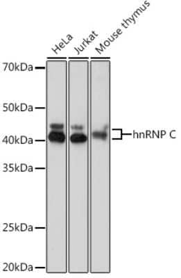 Western Blot: hnRNP C1 + C2 Antibody (7A10N5) [NBP3-16725]