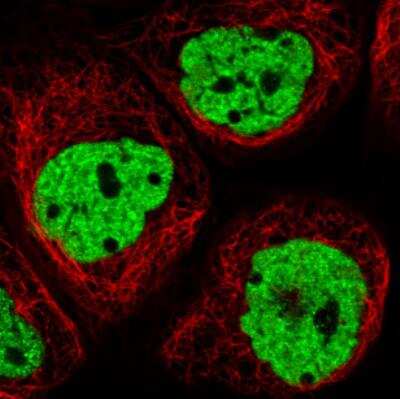 Immunocytochemistry/ Immunofluorescence: hnRNP C1 + C2 Antibody (CL2593) [NBP2-36776]